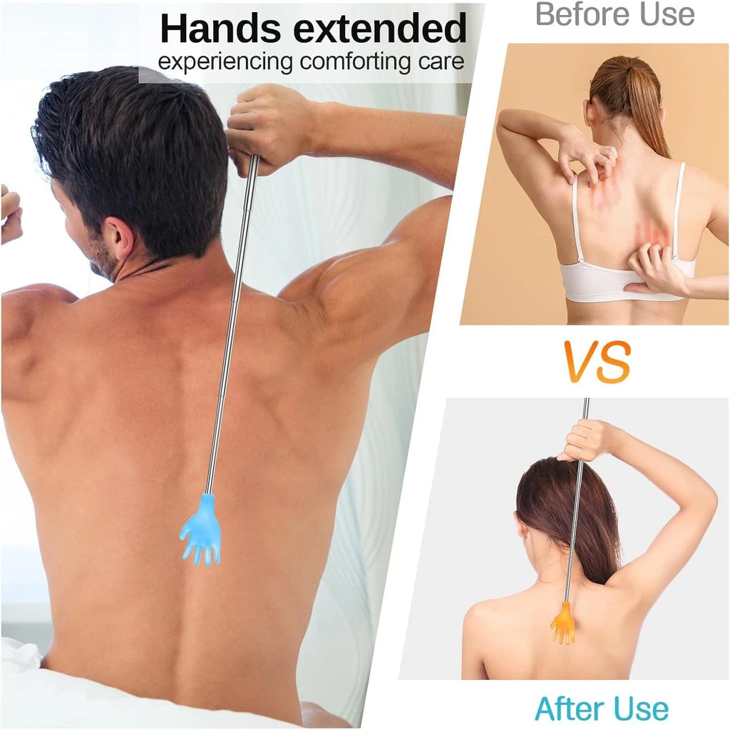 100 Durable Extendable Back Scratchers for Scalp and Body Relief - Yellow & Blue